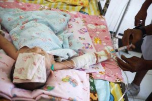 Dializa, făcută sub supraveghere medicală